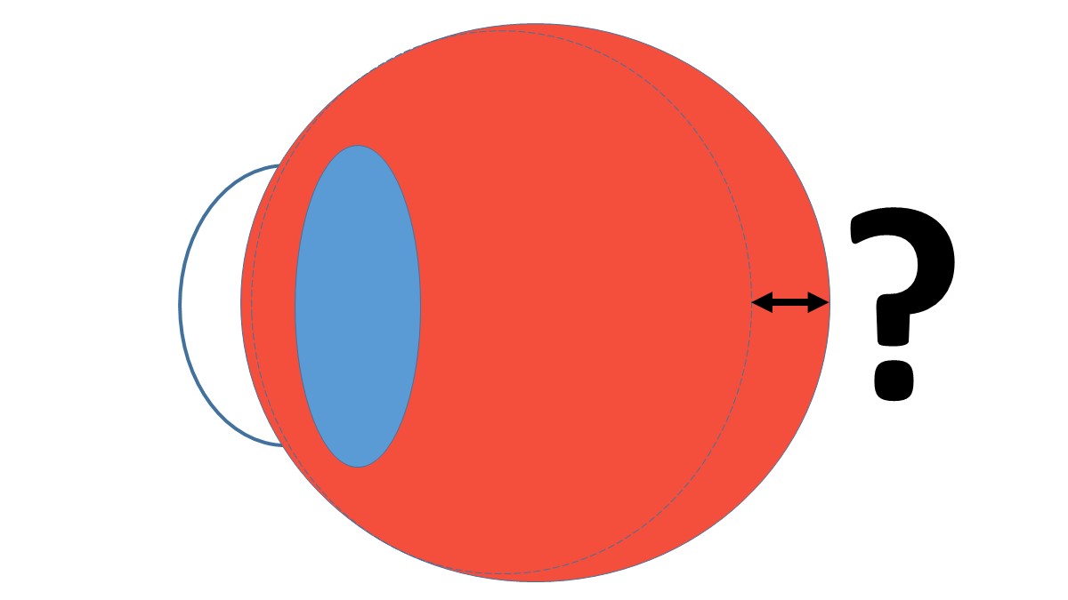 Axial length measurement - a clinical necessity?