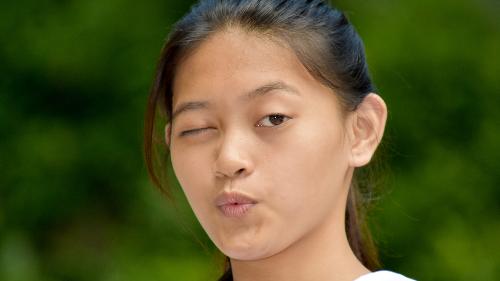 BLINK study results: comparing +1.50 vs +2.50 add multifocal contact lenses for myopia control