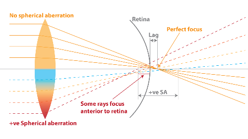 Spherical aberration, accommodation and multifocal soft contact lenses