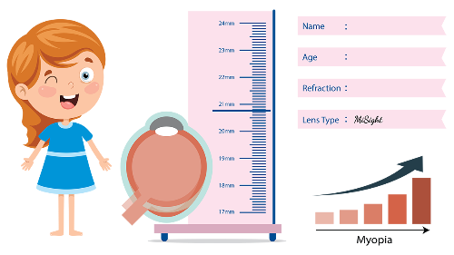 Using growth charts to track progression of myopia - can they be used to predict success with MiSight?