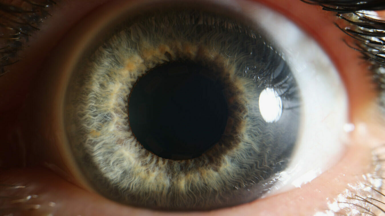 Pupil-e1657345036881.jpg