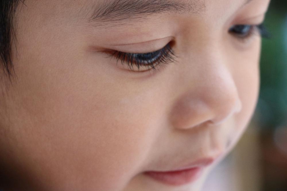 Eyelashes on toddler_Should we fit orthokeratology to a child with trichiasis.jpg