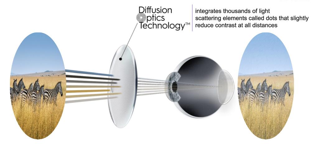 Retinal contrast DOT.jpg