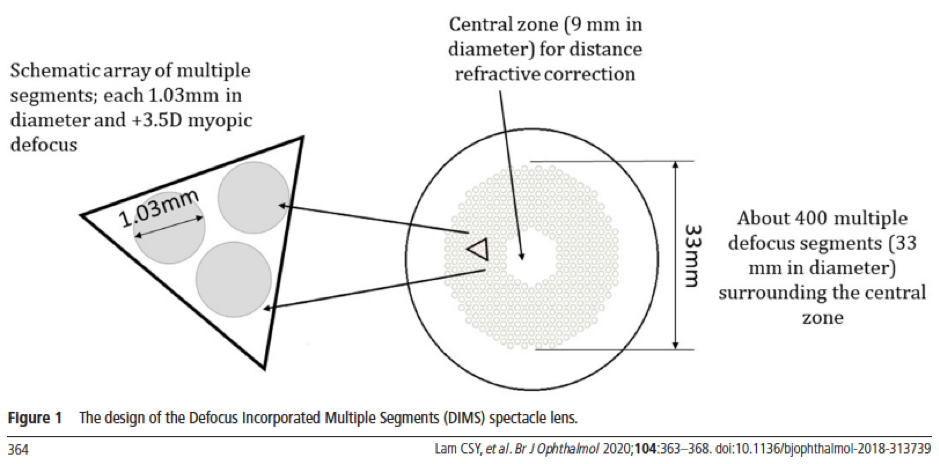 Myopia-Control-Spec-lens-design-1.png