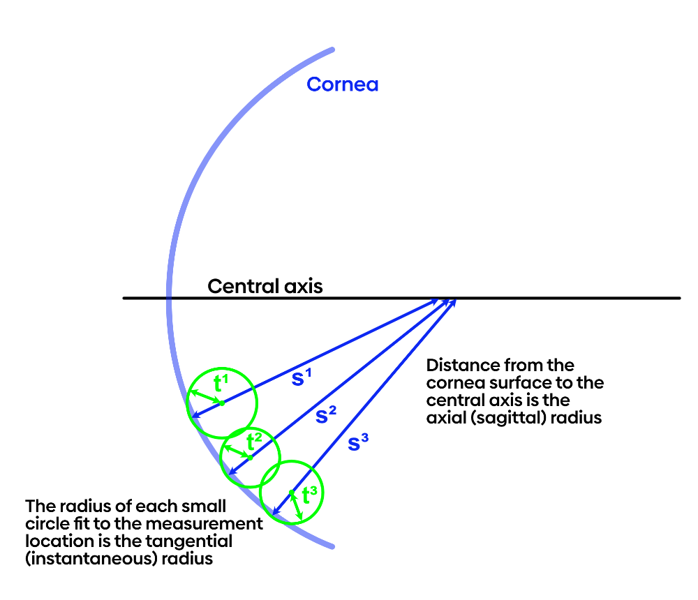 Tangential radius vs axial radius at peripheral locations.png