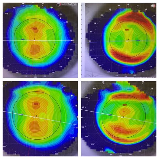 topo pic - non compliant case.jpg