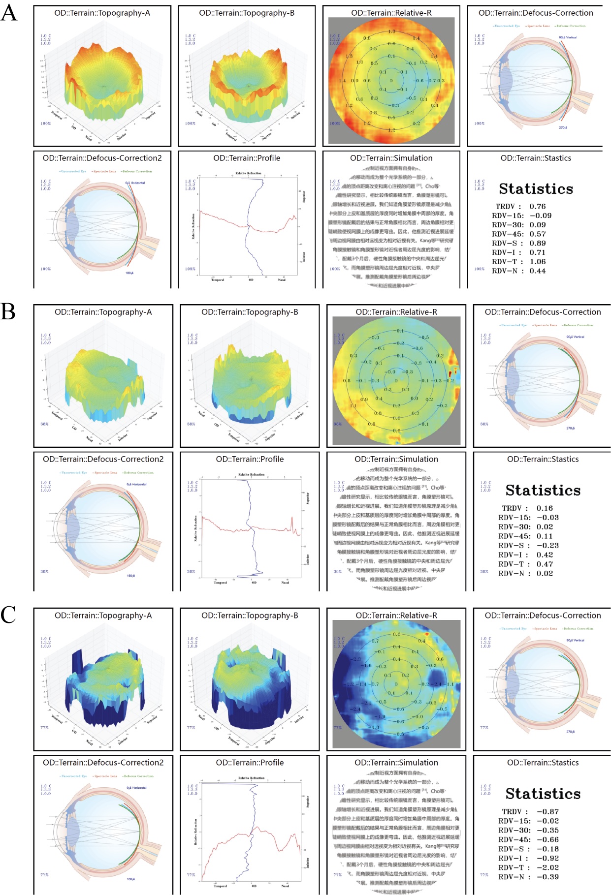 MRT_after_myopic_LVC_figure (1).jpg