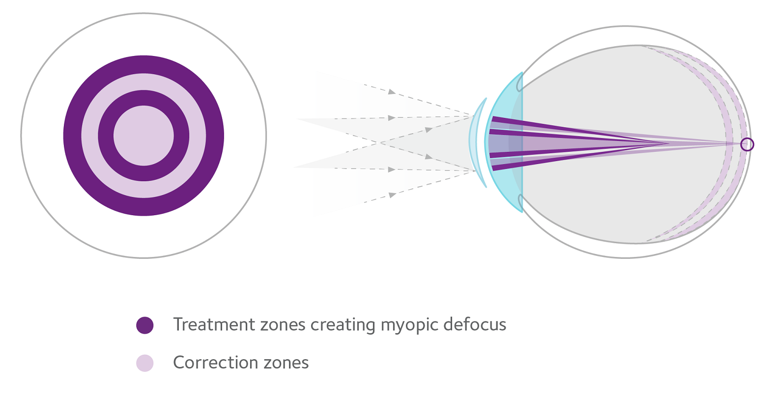 treatment-zone-1575.png