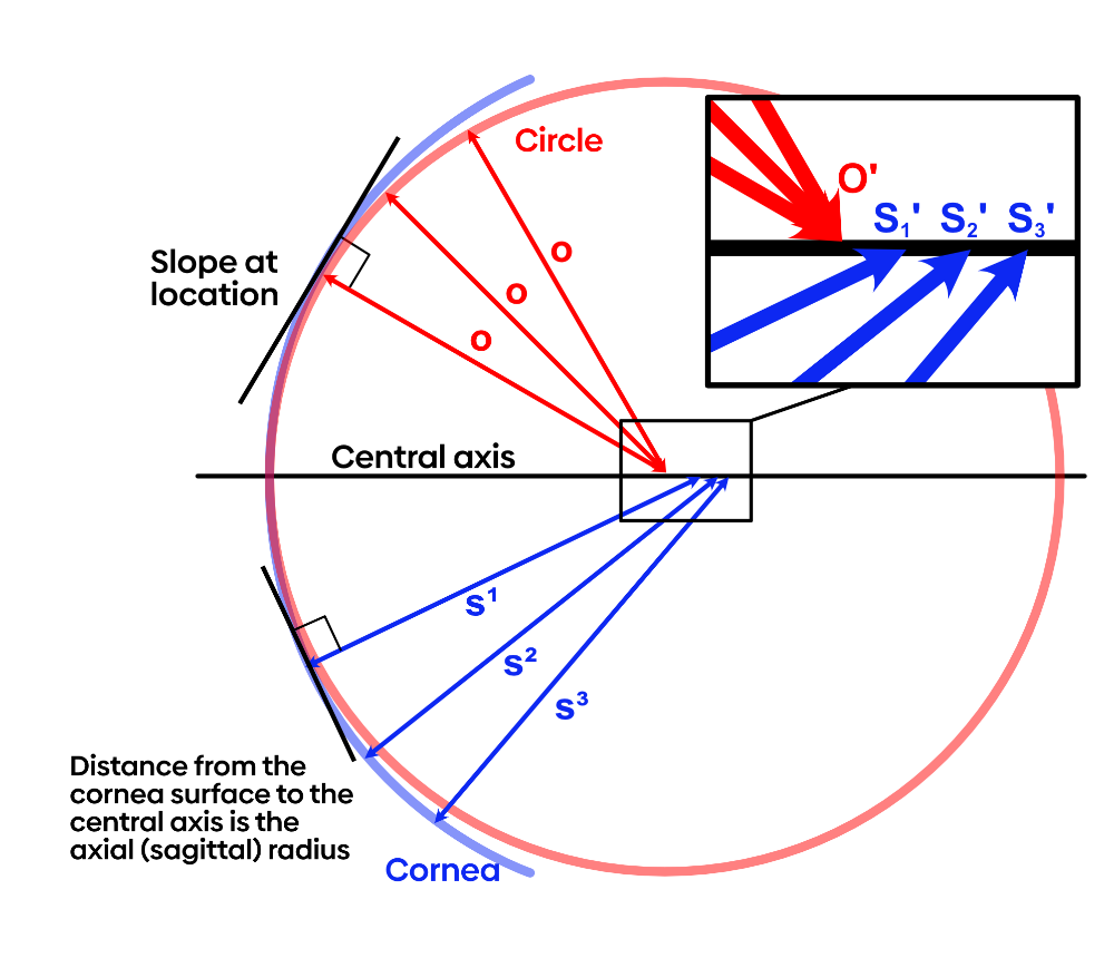 Axial radius sphere vs cornea.png