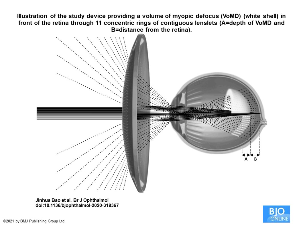 HAL-lens-Stellest.jpg